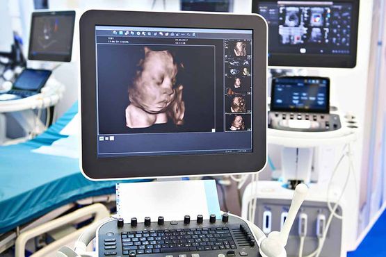 3D und 4D-Ultraschall | Dr. med. Jörg Rosenfeld - Facharzt für Gynäkologie und Geburtshilfe, Spezielle Geburtshilfe und Perinatalmedizin Pränatalmedizin / Pränataldiagnostik, DEGUM II