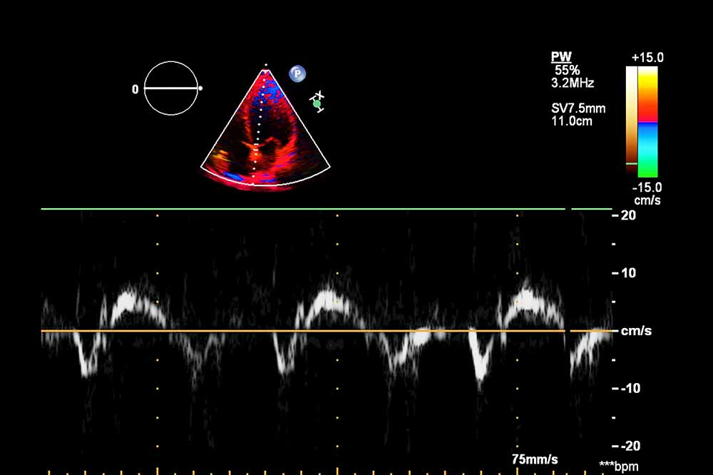 Organultraschall und Echokardiographie | Dr. med. Jörg Rosenfeld - Facharzt für Gynäkologie und Geburtshilfe, Spezielle Geburtshilfe und Perinatalmedizin Pränatalmedizin / Pränataldiagnostik, DEGUM II